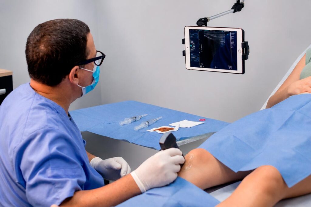 Infiltración eco guiada de rodilla en Cancún con ultrasonido para tratamiento del dolor articular.