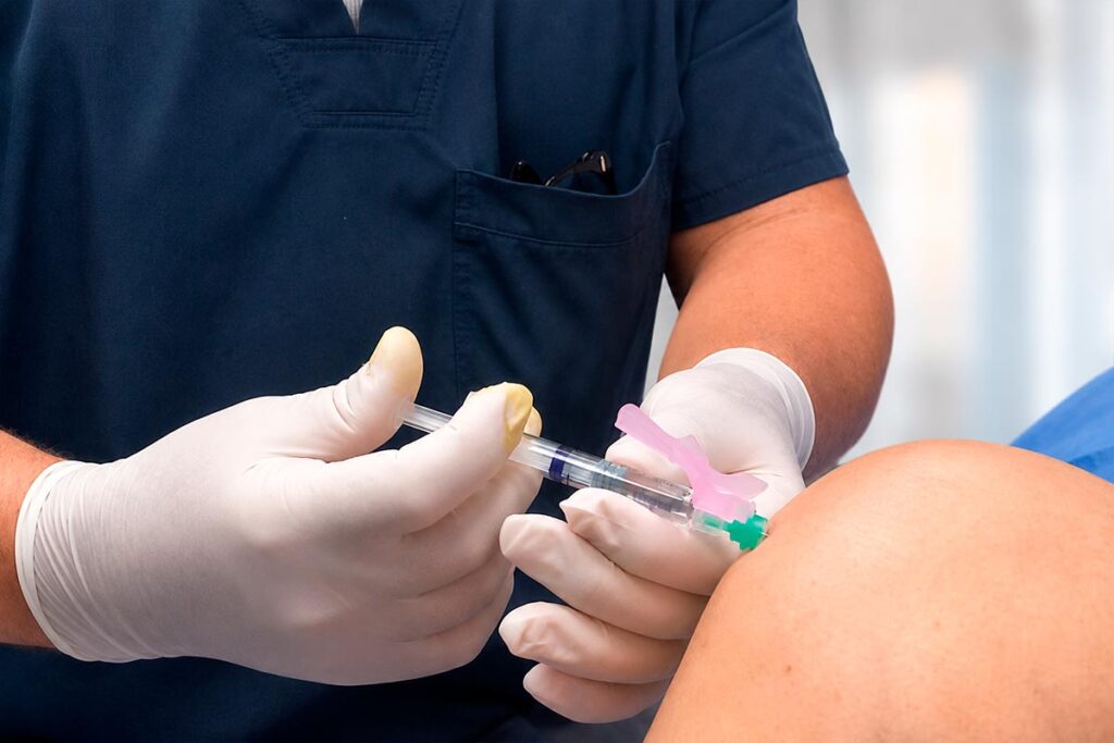 Viscosuplementación de rodilla en Cancún para tratamiento del dolor articular y desgaste de cartílago.